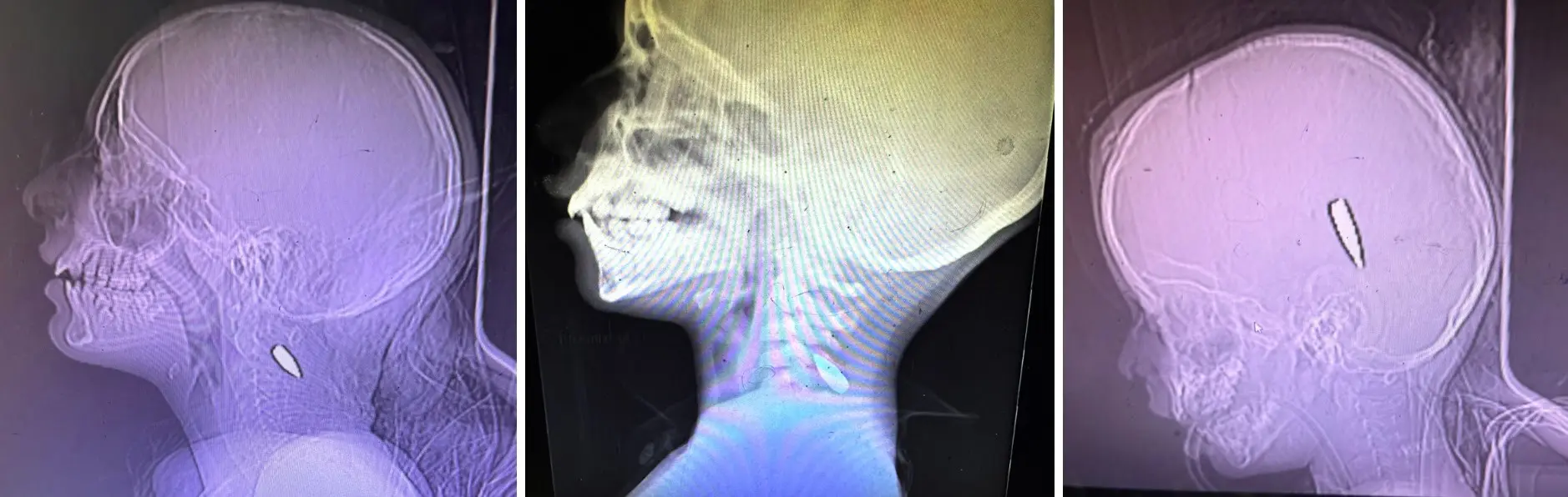 Israel’s Gaza War Crimes Laid Bare, By Medics Who Tell of Snipers Targeting Children Israel’s Gaza War Crimes Laid Bare, By Medics Who Tell of Snipers Targeting Children
