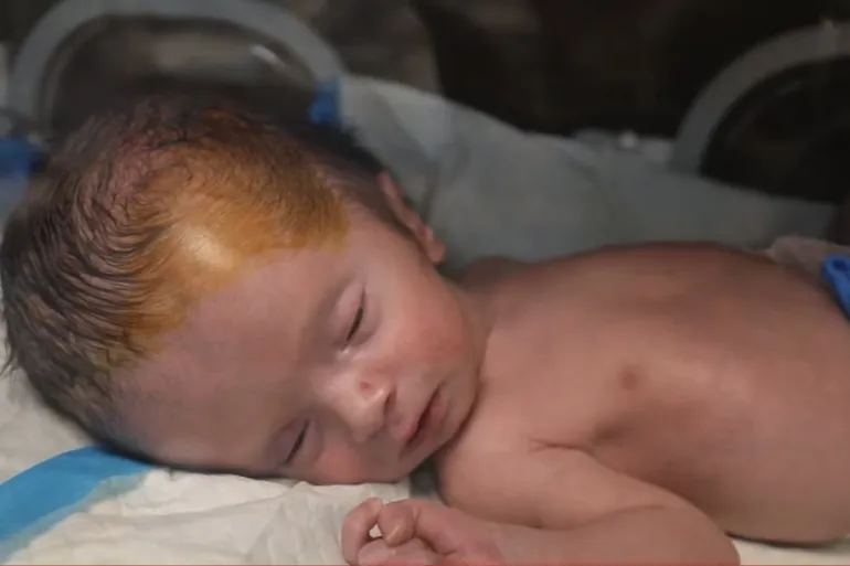 Gaza’s Newborns Bear the Toll of Israel’s Genocide as MSF Finds Malnutrition Linked to Premature Births and Infant Deaths Gaza’s Newborns Bear the Toll of Israel’s Genocide as MSF Finds Malnutrition Linked to Premature Births and Infant Deaths